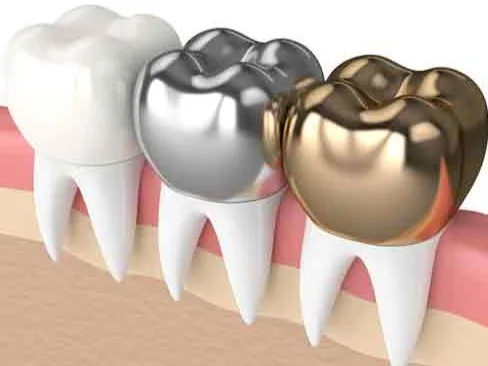 Crowns